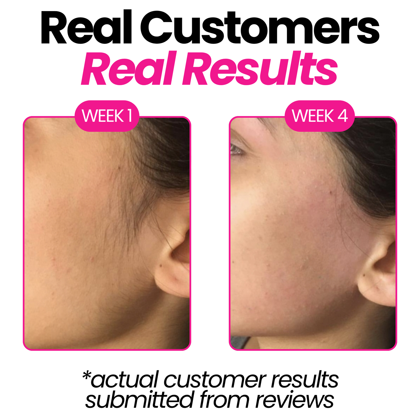 Flossity™ Cyperus Rotundus Skin Serum