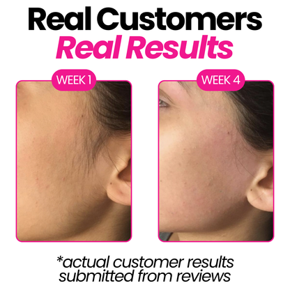 Flossity™ Cyperus Rotundus Skin Serum